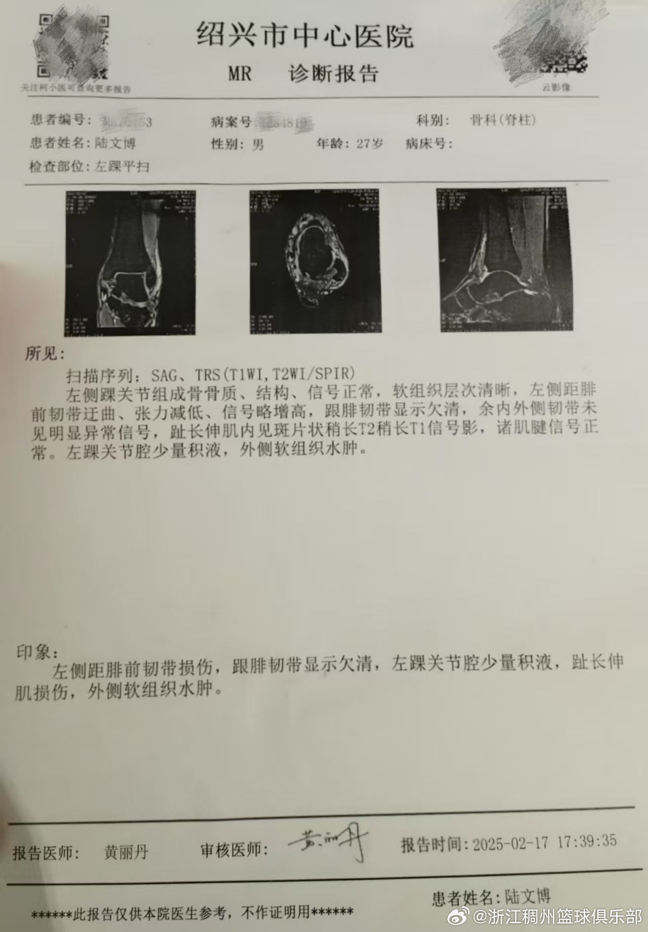 切尔西的阵